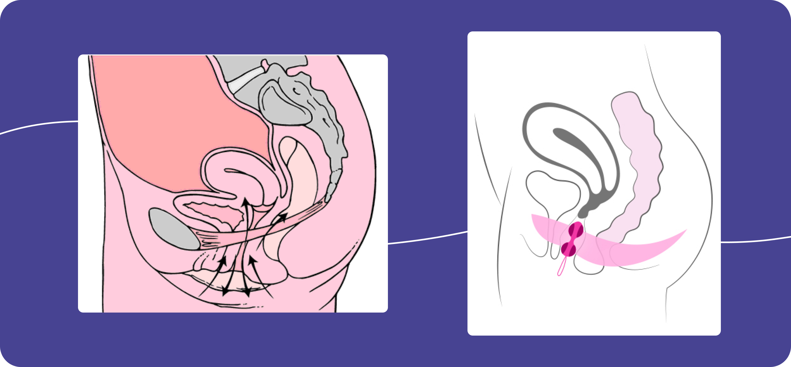 Как пользоваться вагинальными шариками